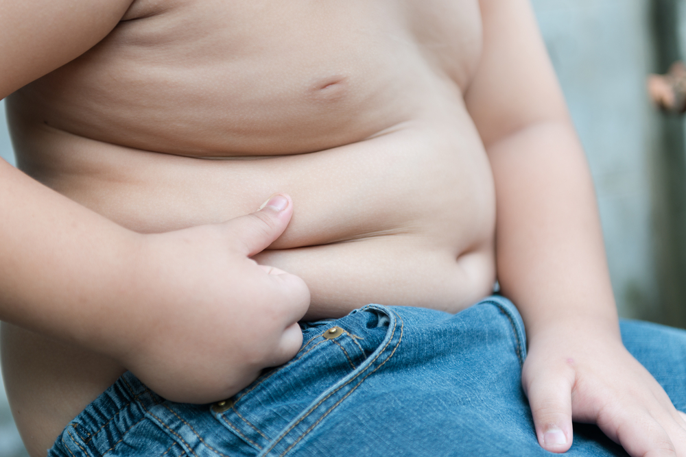 Childhood Obesity May Benefit from Bariatric Surgery