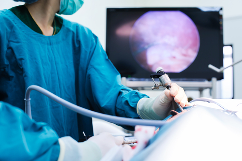 Fractyl Laboratories’ Revita Study Reveals That Procedure Controls Type 2 Diabetes As Well As Invasive Bariatric Surgery Procedures