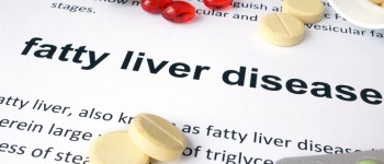 Nonalcoholic Fatty Liver Disease and Obesity
