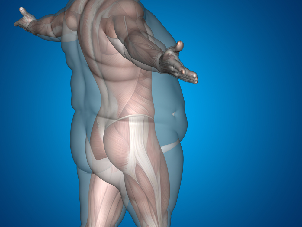 Weight Loss Surgery Improves Testosterone Levels in Obese Men, Without Hormonal Replacement