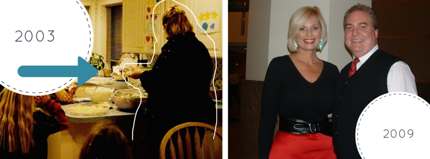 lap band karen gillman before and after